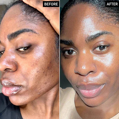 Radiant Glow Duo Peeling Kit