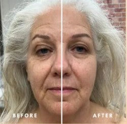 Nendure™ Lymphatic Face Brush